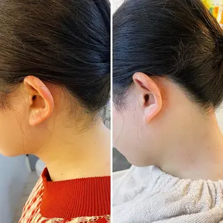 うなじ脱毛/美肌脱毛 LABELのエステ・リラクイメージ