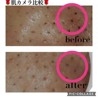 触れたくなる モテ肌へ...❤︎のエステ・リラクイメージ