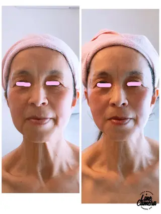 Lupine （エステティシャン）のエステ・リラクイメージ