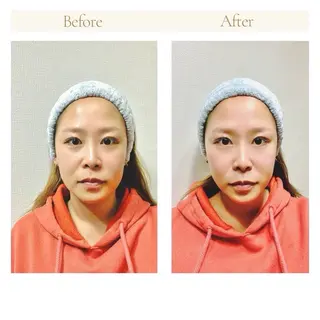 脱毛サロン ニカ所属・☀️脱毛・美容矯正 サロン ニカ☀️のエステ・リラクイメージ