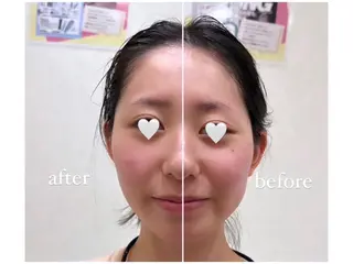 パルティール渋谷店所属・完全個室🌿✨ 痩身・小顔・美肌💖のエステ・リラクイメージ