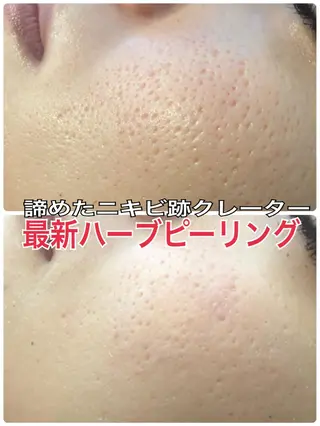 LILIANA所属・LILIANA ☆YURIのエステ・リラクイメージ