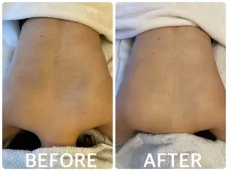 ハーブピーリング横浜 肌質改善専門店のその他イメージ