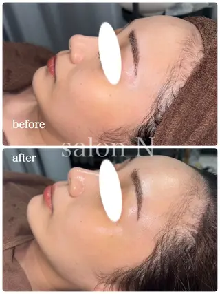 salonＮ所属・24時間営業 ハーブ/毛穴洗浄のエステ・リラクイメージ