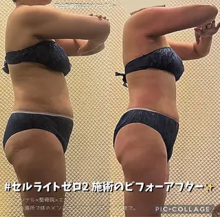 Bodyリカバリー栗山整骨院所属・Arisa✨老廃物や 脂肪をお掃除💪のエステ・リラクイメージ