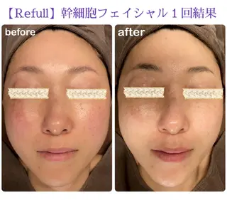 Refull（リフル）所属・Refull （リフル）のエステ・リラクイメージ