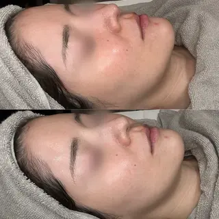 BUB PIBのエステ・リラクイメージ