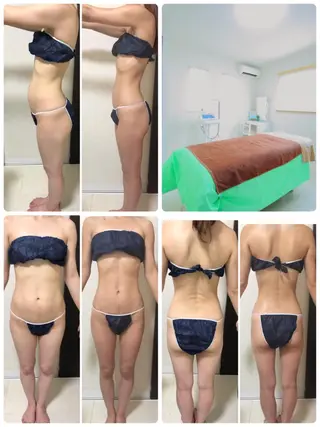 ダイエット／脱毛 美顔／フォト／ハーブのその他イメージ