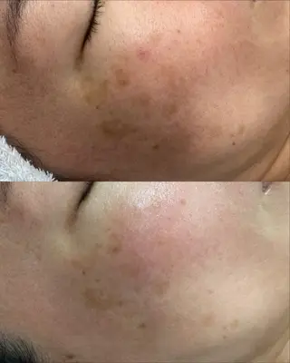 CE salon Euluna所属・CE salon Eulunaのエステ・リラクイメージ