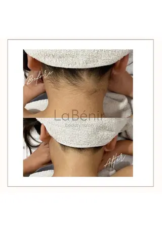 脱毛/美肌【皮膚科看 護師経営】ラベニールのエステ・リラクイメージ