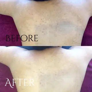 美痩身＆美肌サロン 💐栗原みなのエステ・リラクイメージ