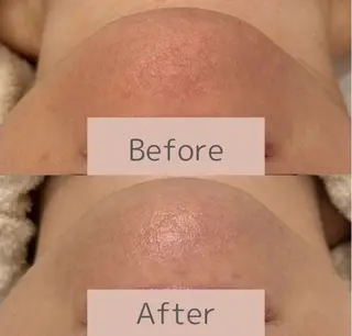 べアール所属・小顔/毛穴/ニキビ salon bealのエステ・リラクイメージ