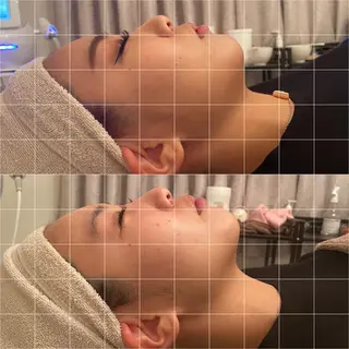 脱毛＆痩身サロン LivLivのエステ・リラクイメージ