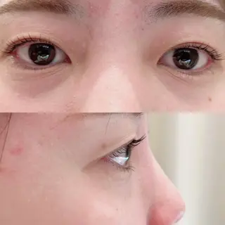 マツエク・マツパ 松岡 アユミ  berryのマツエク・マツパデザイン