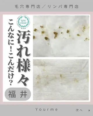 毛穴肌質ケアサロン Yourmeユアミーのエステ・リラクイメージ