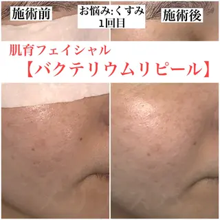 佐藤 奈々のエステ・リラクイメージ