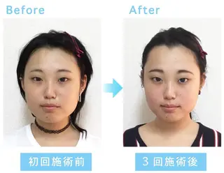 Lov. it ラヴィットのエステ・リラクイメージ