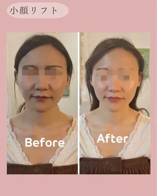 NICORI　小顔&肌質改善専門店所属・小顔＆肌質改善 NICORIのエステ・リラクイメージ