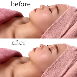 脱毛サロンTTe もものエステ・リラクイメージ