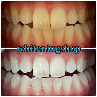 ホワイトニング ショップ吉祥寺店のエステ・リラクイメージ