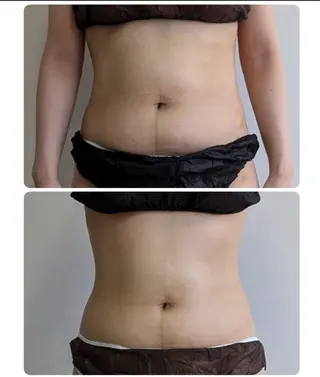 痩身/デトックス しほのエステ・リラクイメージ