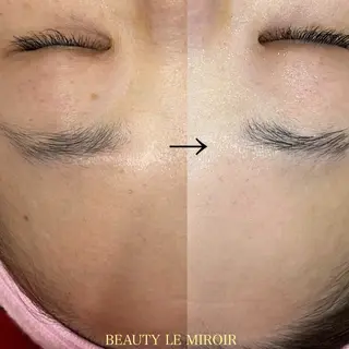 ビューティー ミロワールのエステ・リラクイメージ