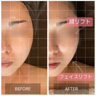 MIRAI小顔 錦糸町店のエステ・リラクイメージ