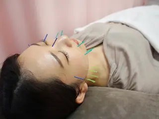 同心整骨院 美容鍼・整体・小顔のエステ・リラクイメージ