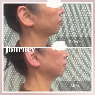 ヘッドフェイス&ボディJourney所属・小顔&ボディ Journeyのエステ・リラクイメージ