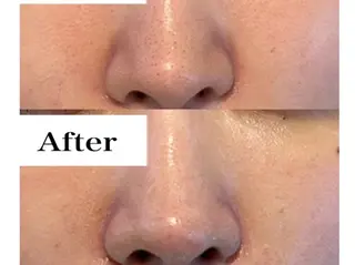 Belle 天王寺店所属・韓国肌管理Belle 天王寺のエステ・リラクイメージ