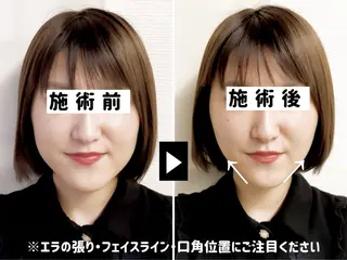 小顔美容鍼専門サロン 渋谷YZのその他イメージ