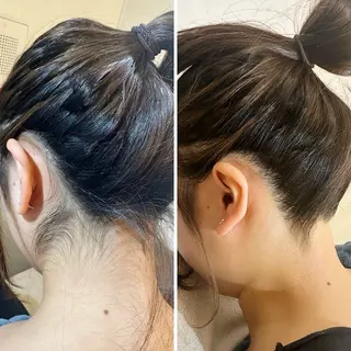 うなじ脱毛/美肌脱毛 LABELのエステ・リラクイメージ