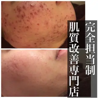 ミディアム カラー パーマ ヘアアレンジ メンズ キッズ ネイル マツエク・マツパ ニキビ・肌質改善専門 ♡人生が変わるサロンのエステ・リラクイメージ