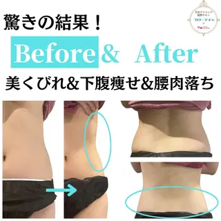 部分痩せ♥️小顔専門 MIKUのエステ・リラクイメージ