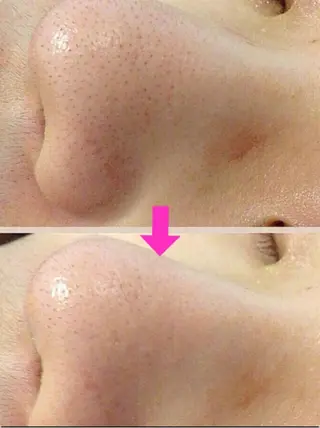 痩身リンパダイエット 隠れ家サロンチャームのエステ・リラクイメージ