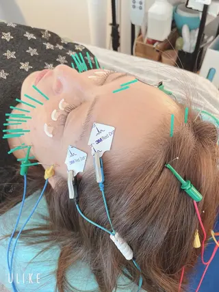 小顔美容鍼専門サロン 渋谷YZのその他イメージ