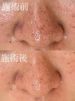 トータルビューティー サロンLilyのエステ・リラクイメージ