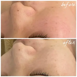 メンズ メナード岐阜市茜部 杉浦のエステ・リラクイメージ