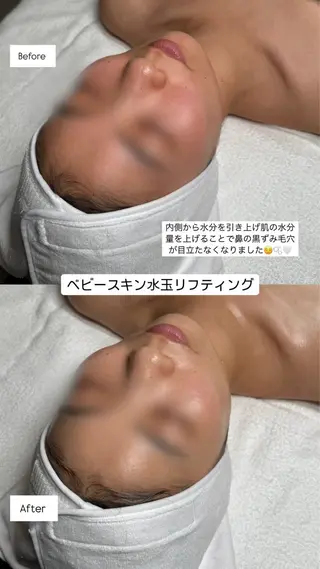 韓国肌管理🫧LDM 🫧Junnaのエステ・リラクイメージ