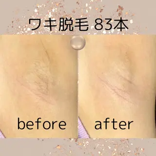 中庄駅前エステ BRILLAR小豆のヘアスタイル