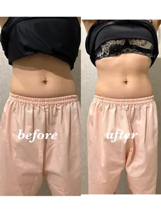 腸活サポート みなみののエステ・リラクイメージ