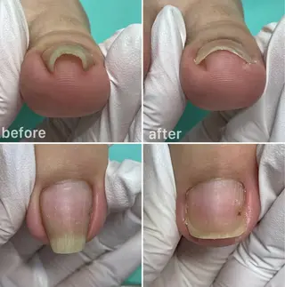 福岡巻き爪補正店 博多店のエステ・リラクイメージ