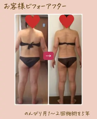 エステサロンNerice所属・トロふわ愛され 美ボディNericeのエステ・リラクイメージ