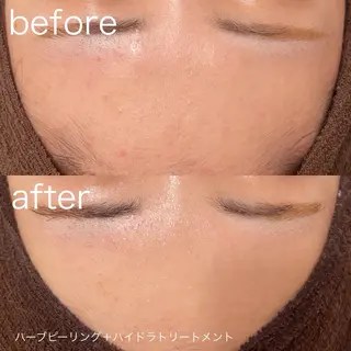 lulula ricoのエステ・リラクイメージ