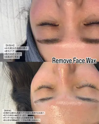 Remove所属・Remove .のエステ・リラクイメージ