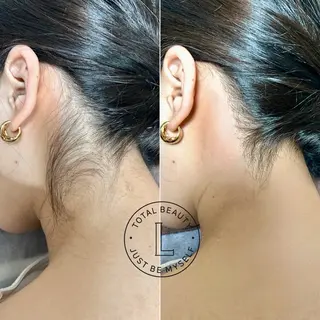 脱毛サロンLULA 恵比寿店　笠松のエステ・リラクイメージ