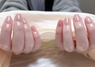 ネイル キン グミのネイルデザイン