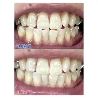 M渋谷店所属・M渋谷 ホワイトニングのエステ・リラクイメージ