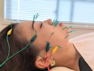 小顔美容鍼灸Acubelle Yakuin.【アキュベル薬院】所属・石川 真梨奈  美容鍼灸/アロマのエステ・リラクイメージ