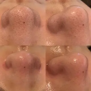 BELCIA福岡店　récolte de BELCIA（レコルトデベルシア）所属・BELCIA福岡店 レコルトデベルシアのエステ・リラクイメージ